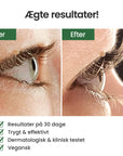 LUXE LASH | Øjenvippeserum