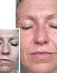 CIT Face Roller PLATINUM